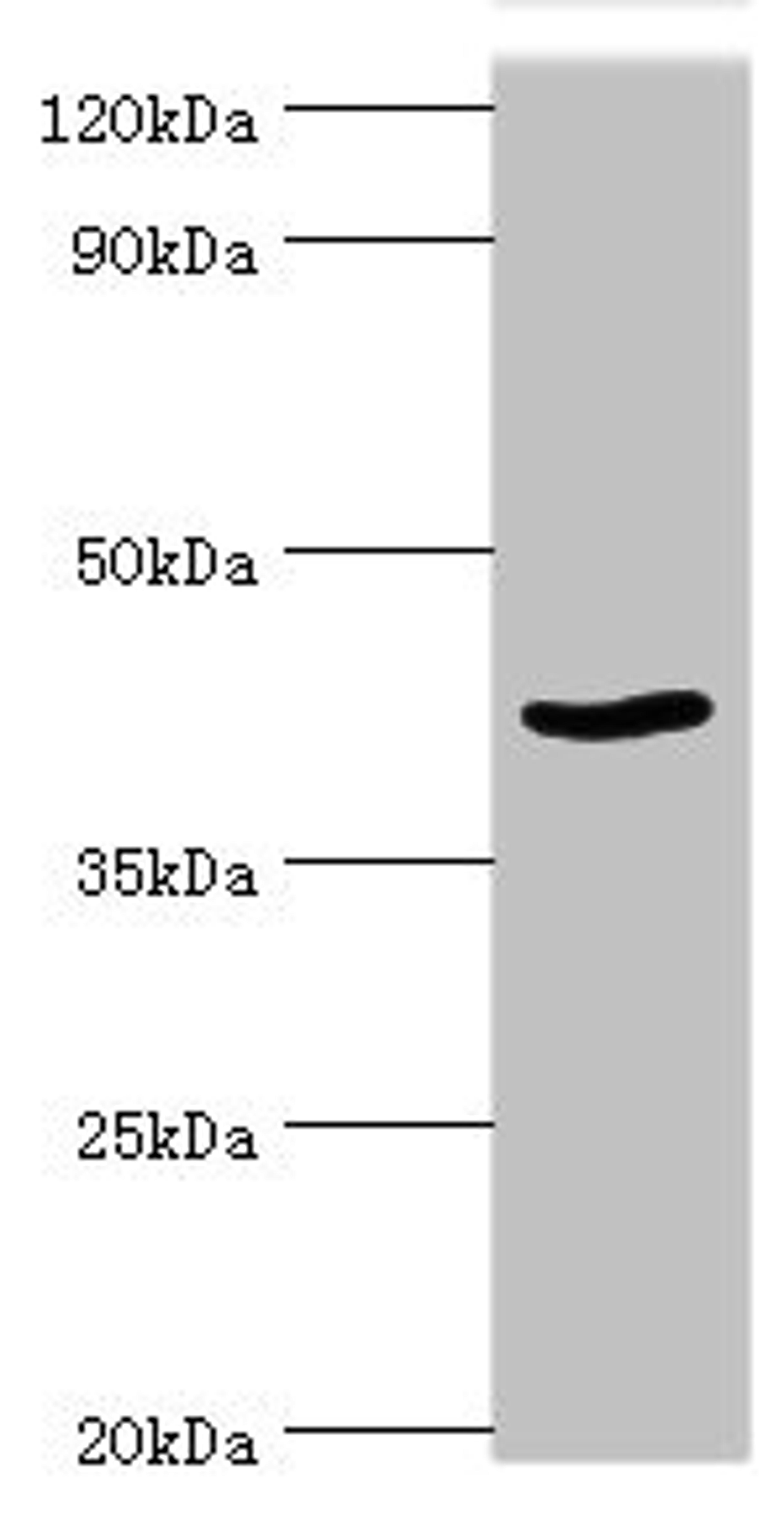 Western blot. All lanes: Protein arginine N-methyltransferase 1 antibody at 2ug/ml + NIH/3T3 whole cell lysate. Secondary. Goat polyclonal to rabbit IgG at 1/10000 dilution. Predicted band size: 42, 40, 41 kDa. Observed band size: 42 kDa. 