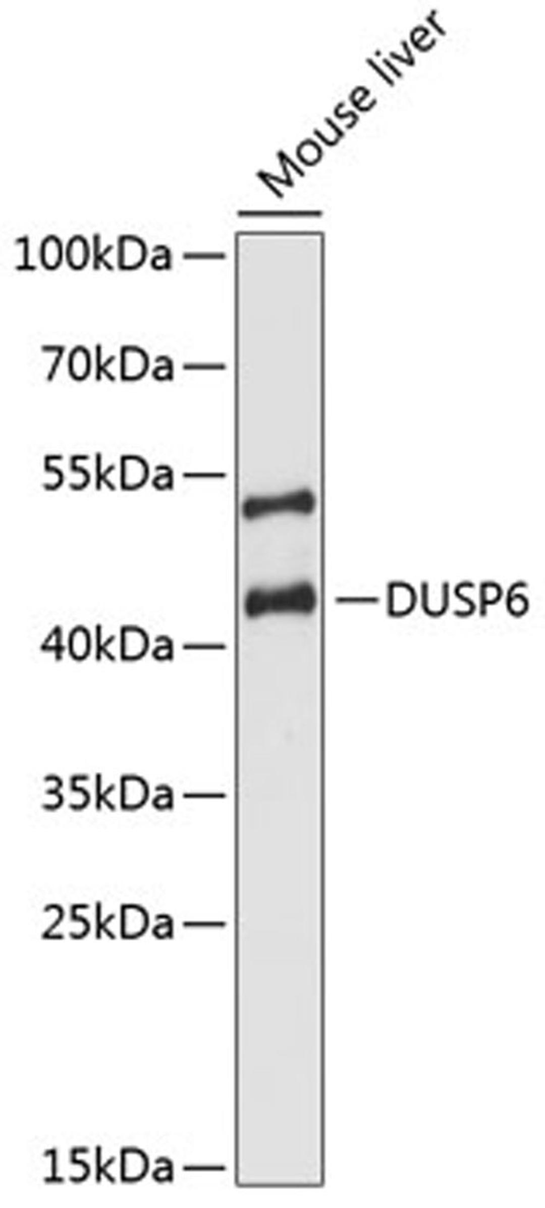 Western blot - DUSP6 antibody (A3171)