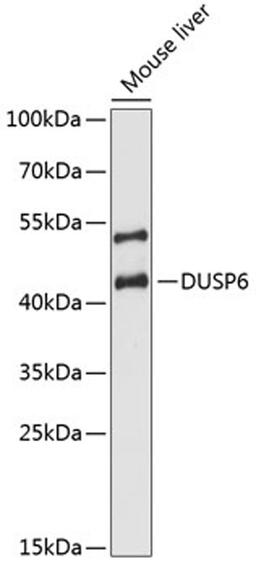 Western blot - DUSP6 antibody (A3171)