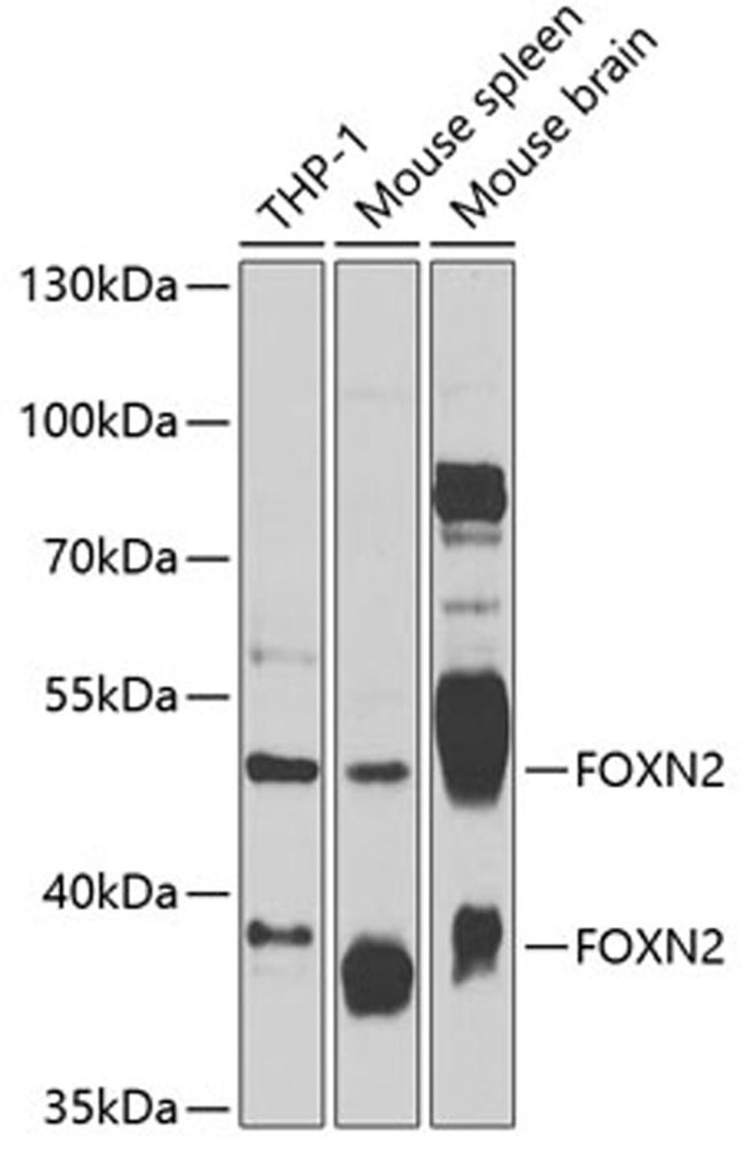 Western blot - FOXN2 antibody (A7185)