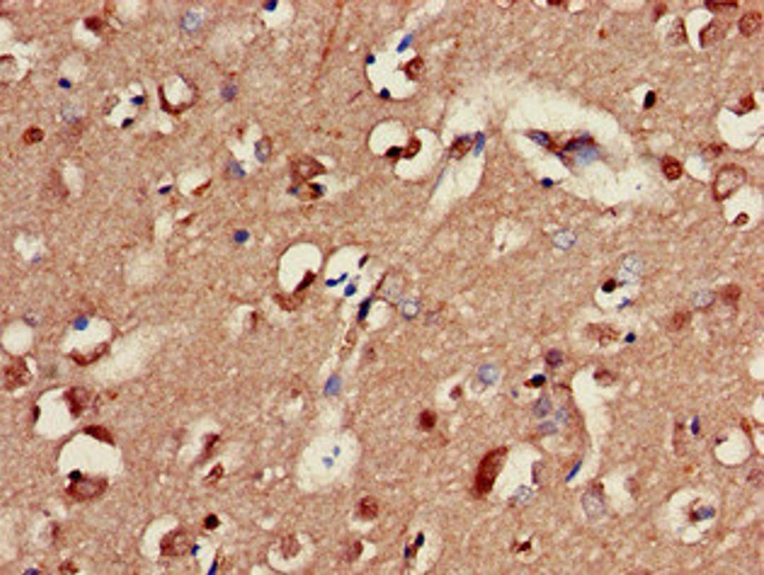 Immunohistochemistry of paraffin-embedded human brain tissue using CSB-PA009141LA01HU at dilution of 1:100