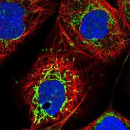 Immunocytochemistry/Immunofluorescence: SMPDL3A Antibody [NBP1-88862] - Staining of human cell line A-431 shows positivity in nucleus, nucleoli & mitochondria.