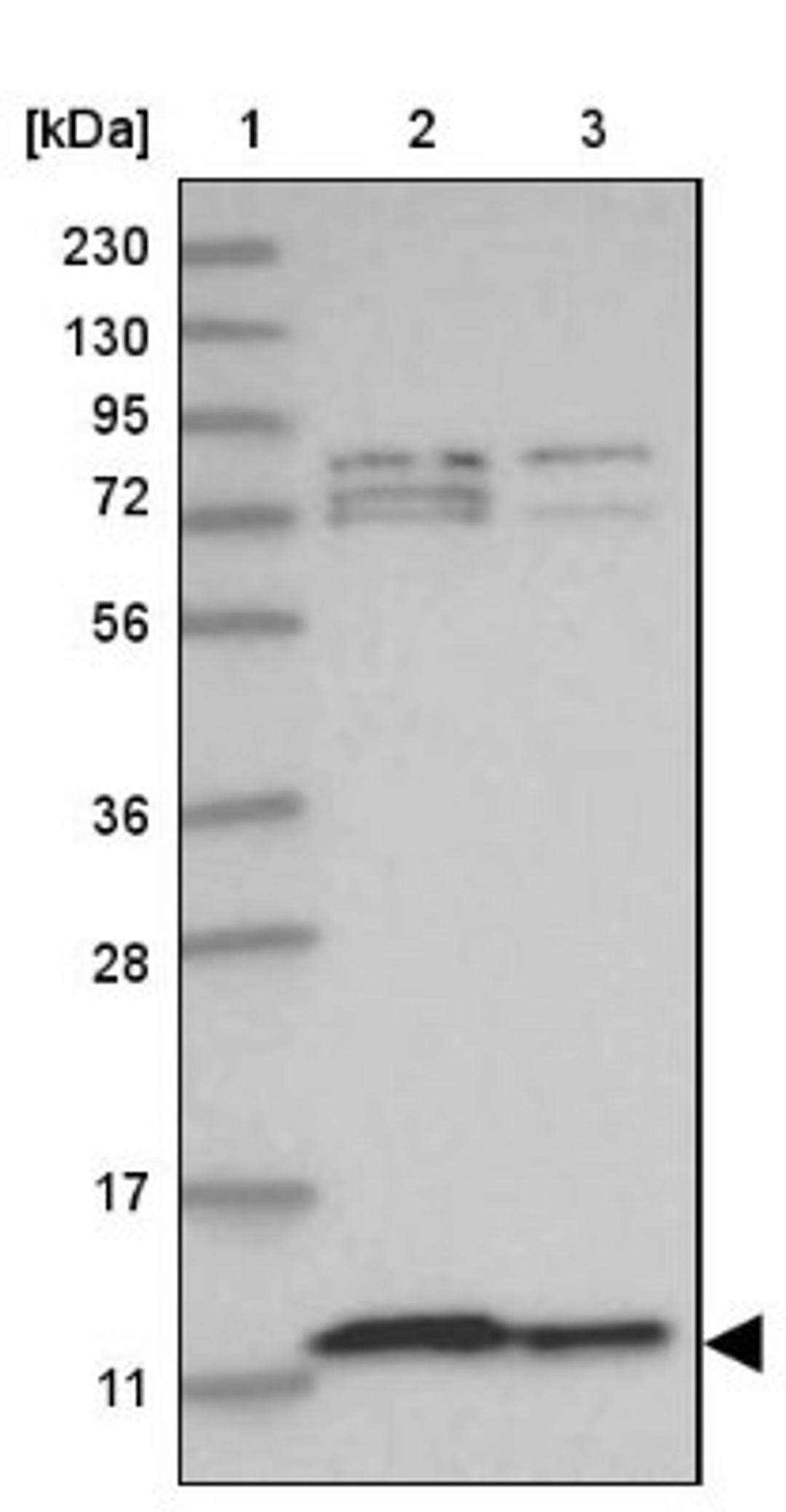 Western Blot: C1orf31 Antibody [NBP1-85948] - Lane 1: Marker [kDa] 230, 130, 95, 72, 56, 36, 28, 17, 11<br/>Lane 2: Human cell line RT-4<br/>Lane 3: Human cell line U-251MG sp