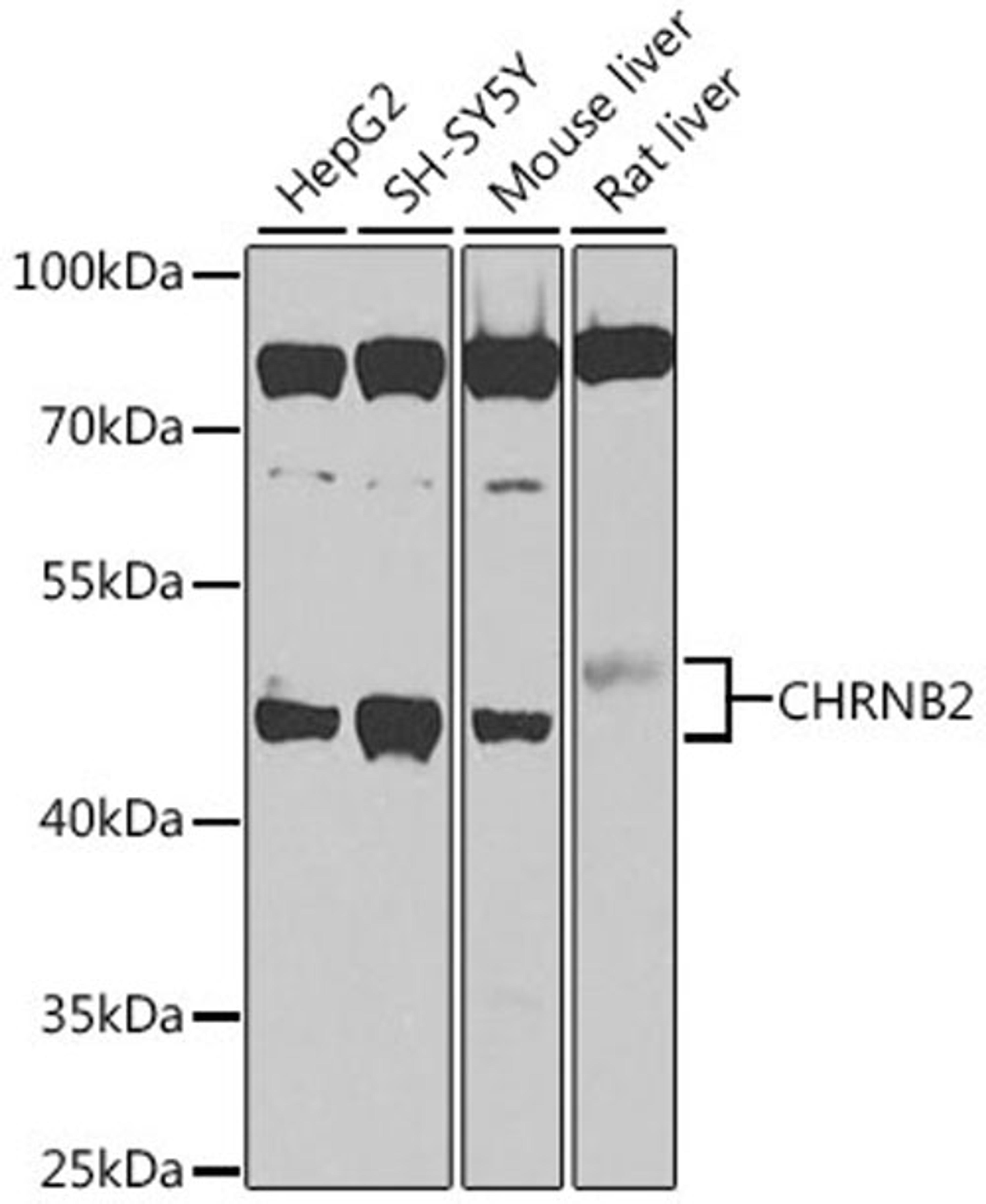 Western blot - CHRNB2 antibody (A9808)