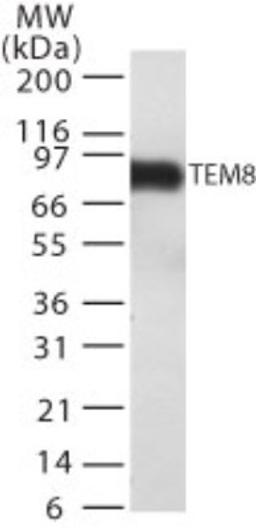 Western Blot: TEM8 Antibody (200C1339(SB20)) [NB100-56585] - detection of TEM8 in TEM8 transfected cell lysate using this antibody.