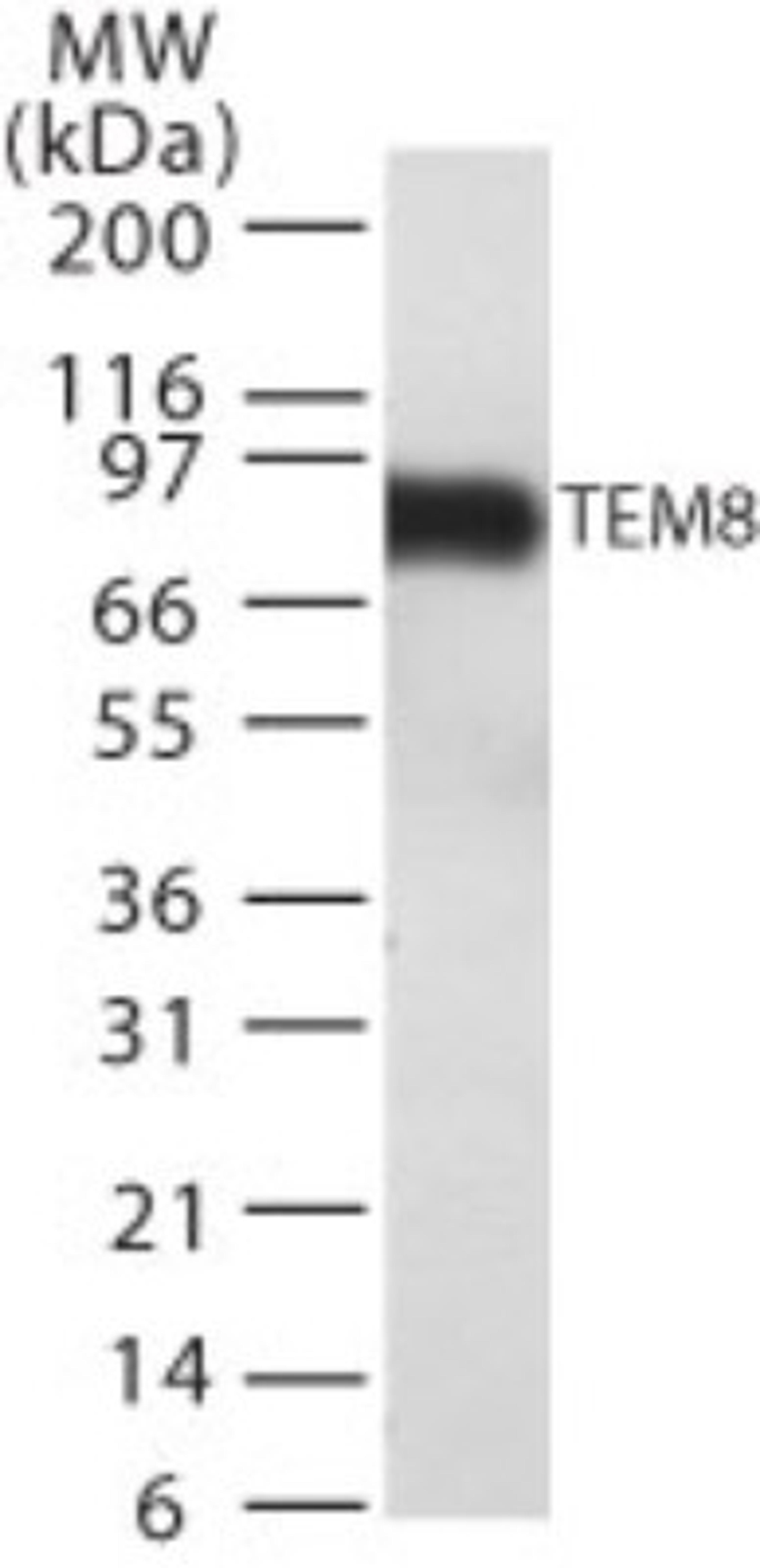 Western Blot: TEM8 Antibody (200C1339(SB20)) [NB100-56585] - detection of TEM8 in TEM8 transfected cell lysate using this antibody.