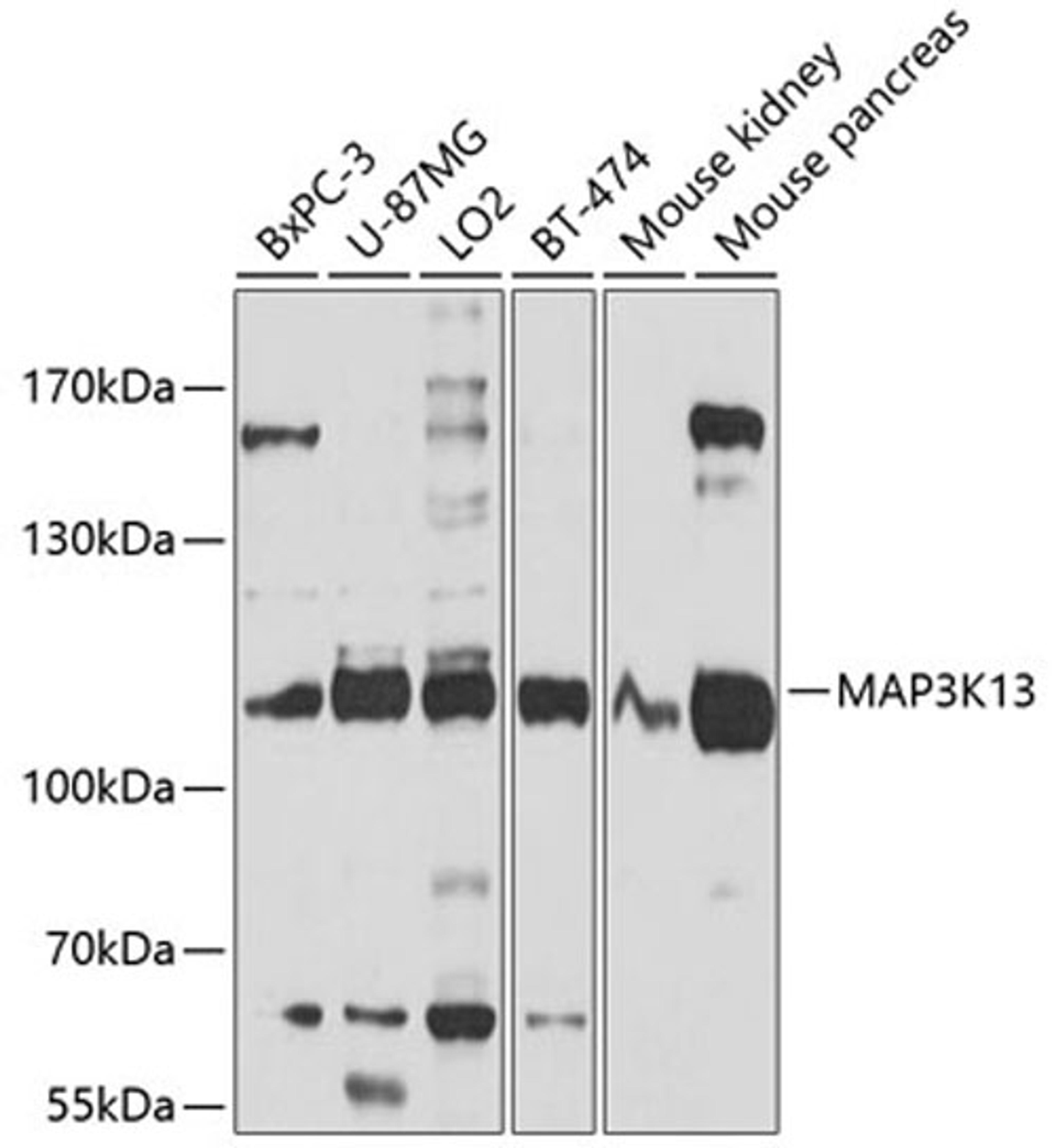 Western blot - MAP3K13 antibody (A10189)