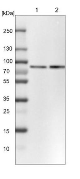 Western Blot: PLAP Antibody [NBP1-84997] - Lane 1: NIH-3T3 cell lysate (Mouse embryonic fibroblast cells)<br/>Lane 2: NBT-II cell lysate (Rat Wistar bladder tumour cells)