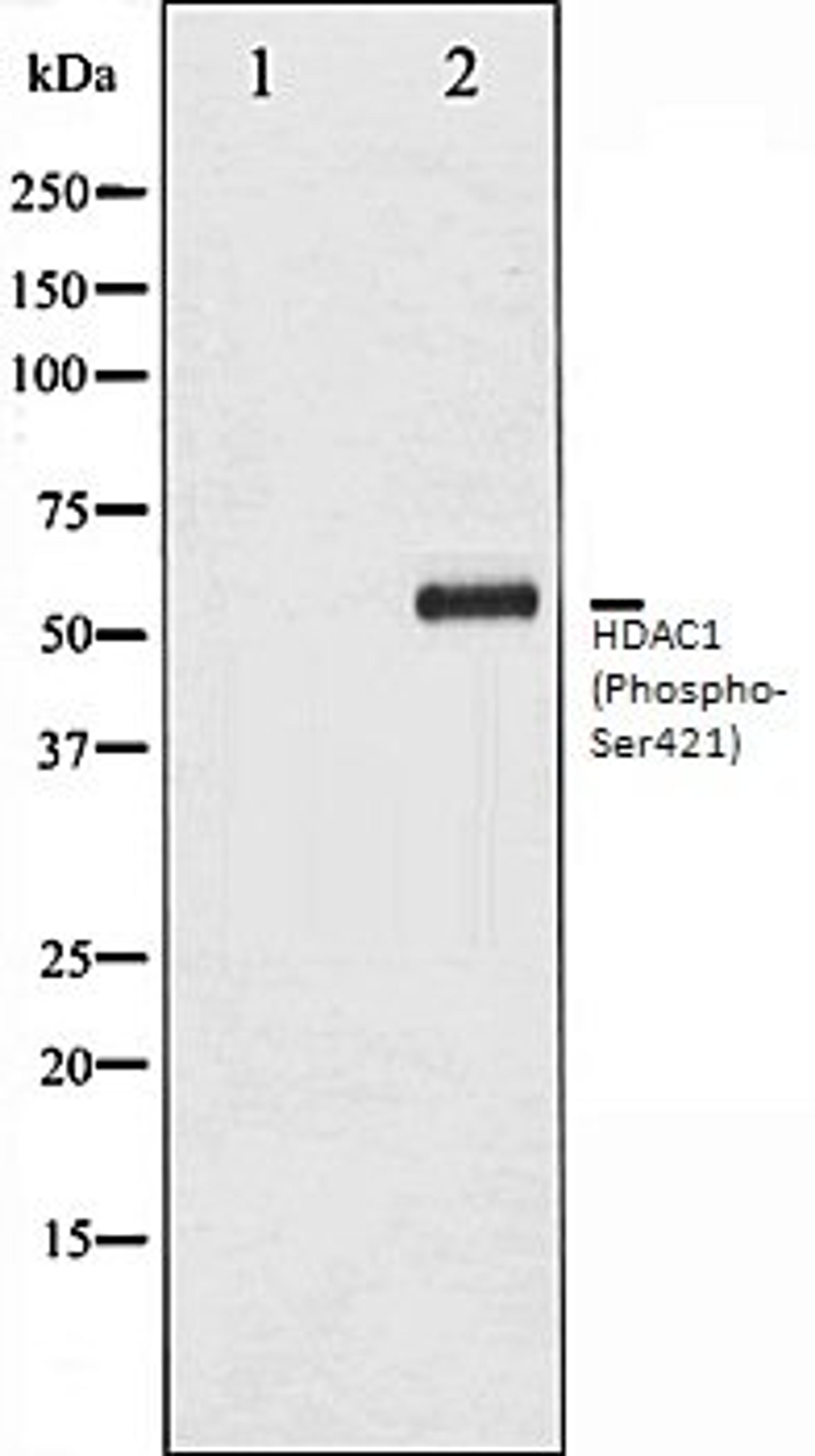 Western blot analysis of Jurkat whole cell lysates using HDAC1 (Phospho-Ser421) antibody, The lane on the left is treated with the antigen-specific peptide.