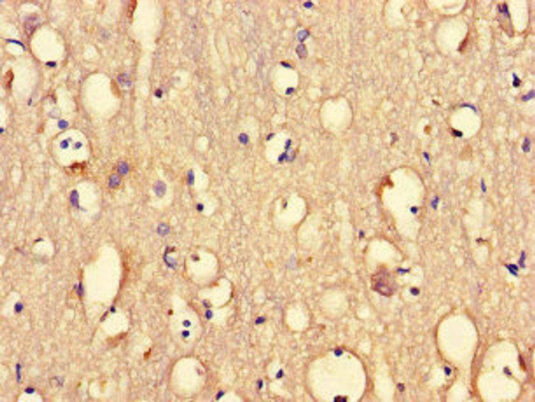 Immunohistochemistry of paraffin-embedded human brain tissue using CSB-PA018734LA01HU at dilution of 1:100