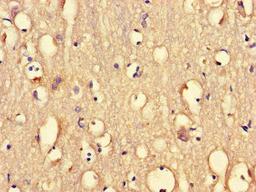 Immunohistochemistry of paraffin-embedded human brain tissue using CSB-PA018734LA01HU at dilution of 1:100