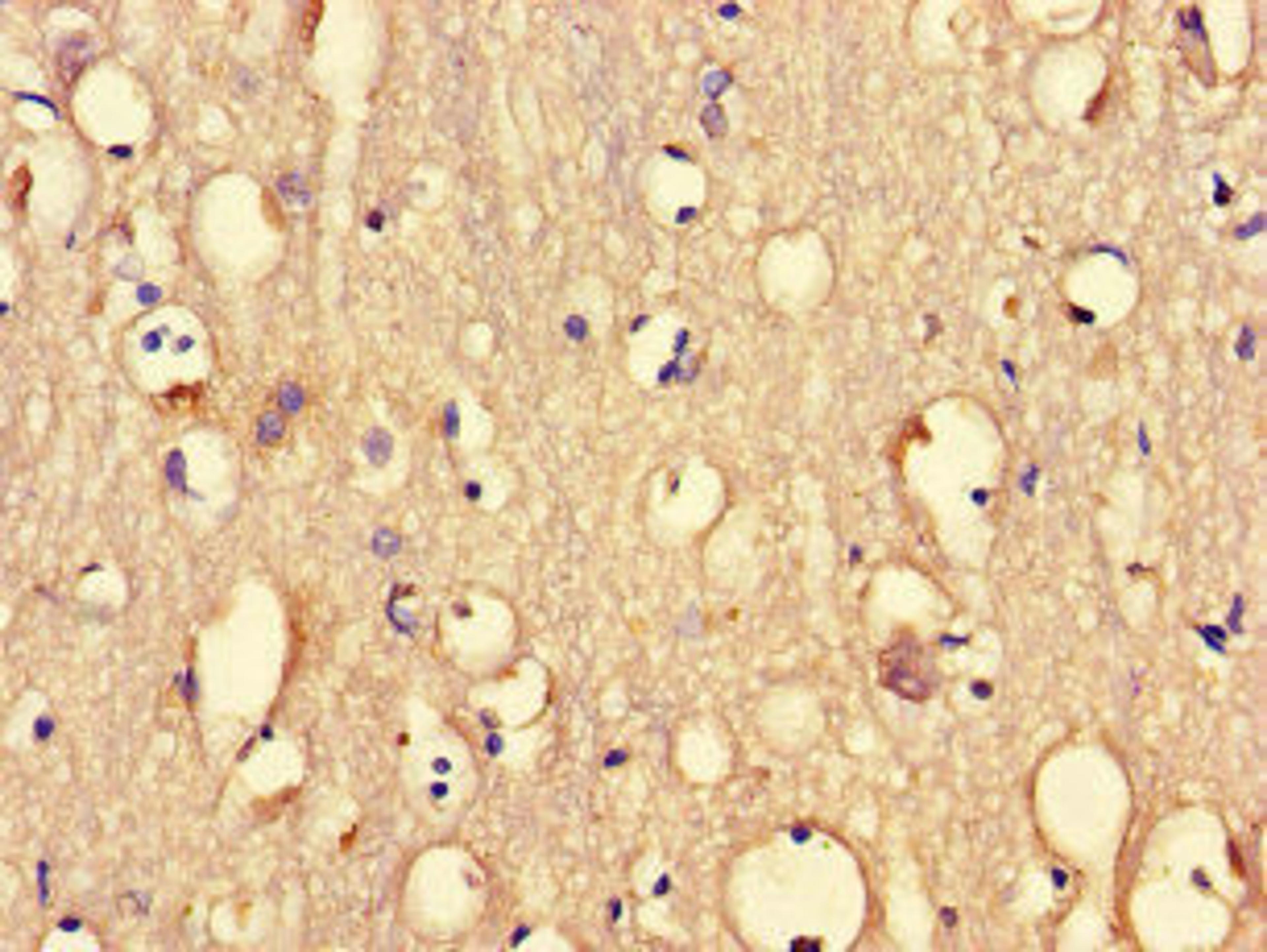 Immunohistochemistry of paraffin-embedded human brain tissue using CSB-PA018734LA01HU at dilution of 1:100