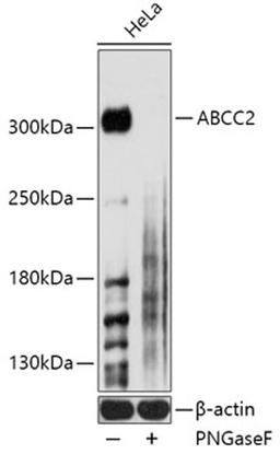 Western blot - ABCC2 antibody (A8405)