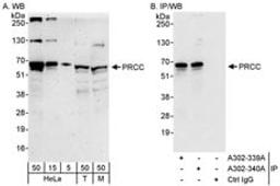 Detection of human and mouse PRCC by western blot (h&m) and immunoprecipitation (h).