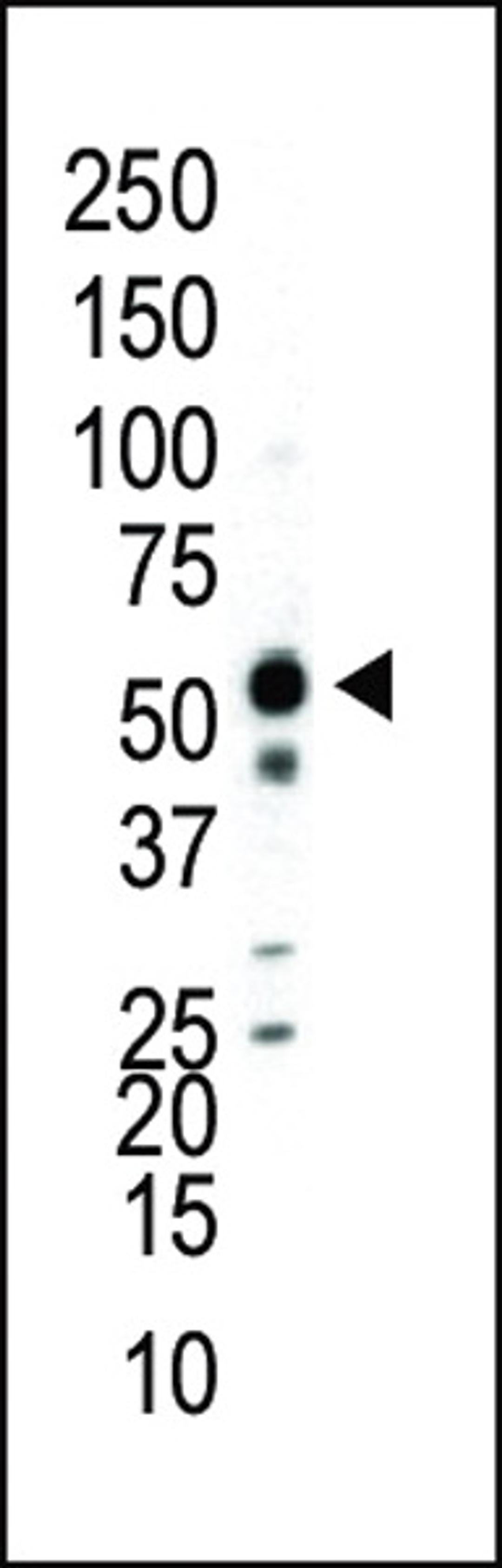 Western blot analysis of anti-JNK2 Pab in Jurkat cell lysate