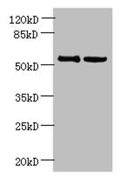Western blot. All lanes: UTP15 antibody at 5µg/ml. Lane 1: Hela whole cell lysate. Lane 2: HepG2 whole cell lysate. Secondary. Goat polyclonal to rabbit IgG at 1/10000 dilution. Predicted band size: 59, 37, 57 kDa. Observed band size: 59 kDa