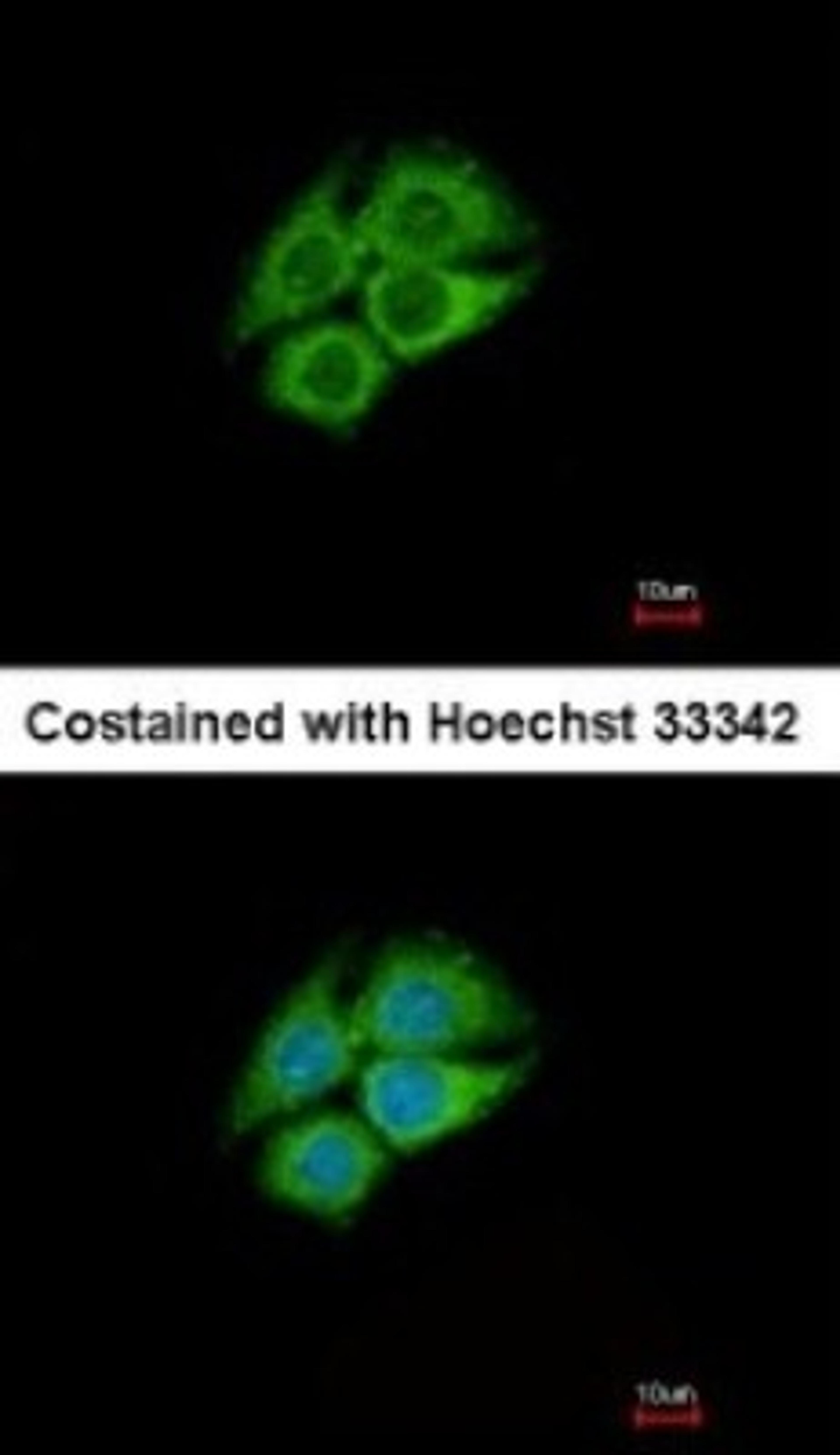 Immunocytochemistry/Immunofluorescence: PANK1 Antibody [NBP1-32509] - Analysis of methanol-fixed Hep G2, using antibody at 1:500 dilution.