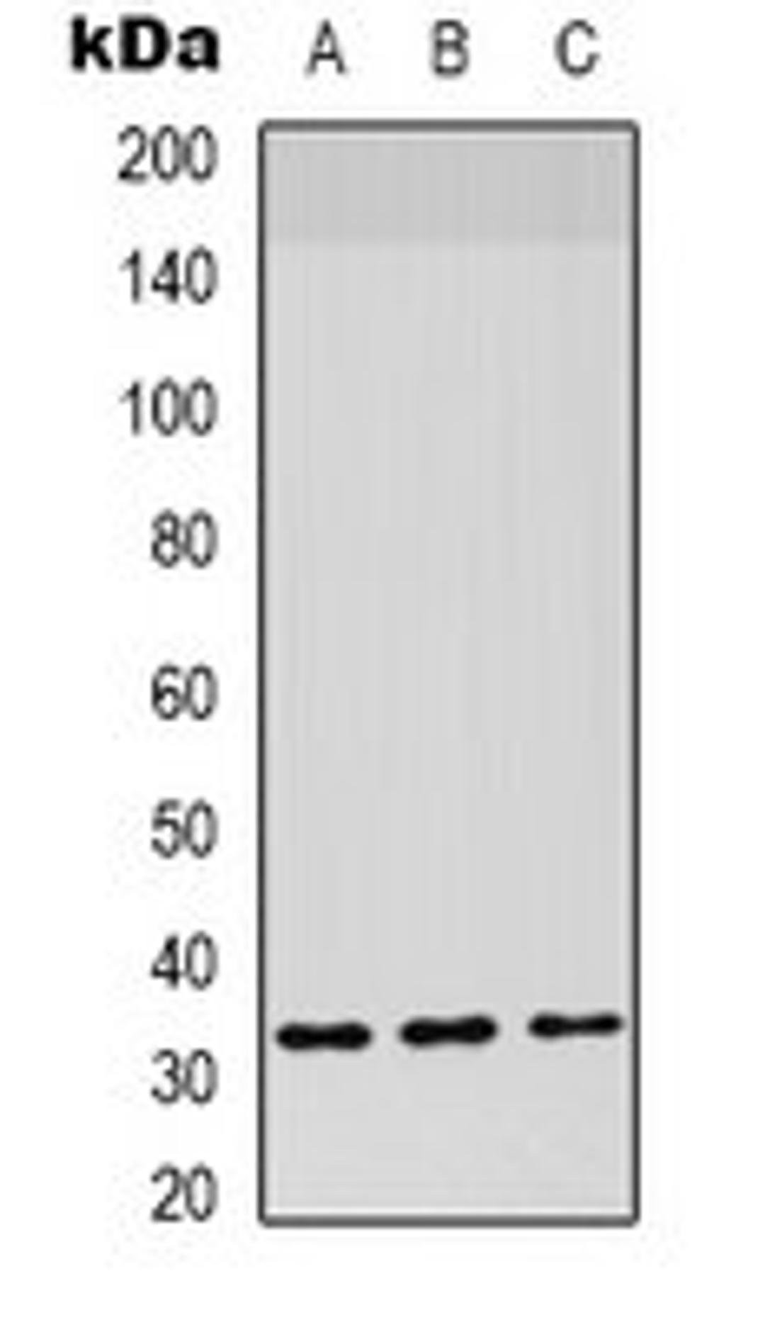 Western blot analysis of HepG2 (Lane 1), mouse lung (Lane 2) whole cell lysates using CD142 antibody