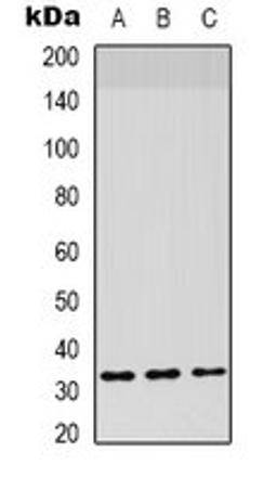 Western blot analysis of HepG2 (Lane 1), mouse lung (Lane 2) whole cell lysates using CD142 antibody