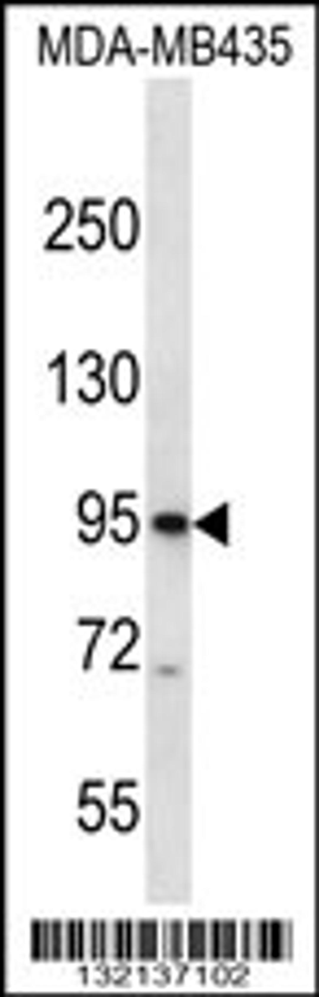 Western blot analysis in MDA-MB435 cell line lysates (35ug/lane).