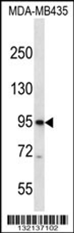 Western blot analysis in MDA-MB435 cell line lysates (35ug/lane).