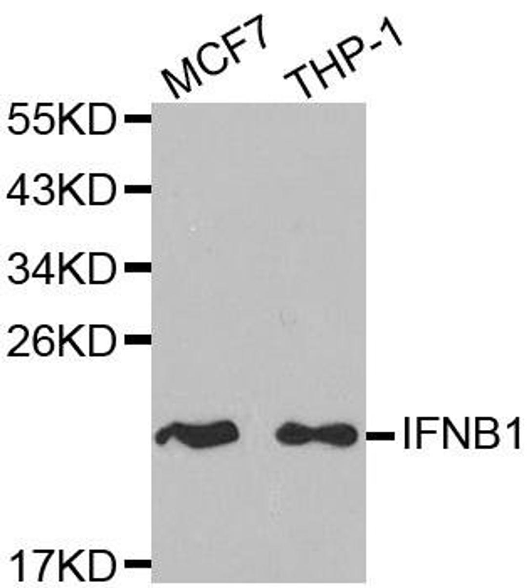 Western blot analysis of extracts of various cell lines using IFNB1 antibody