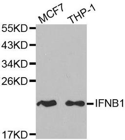 Western blot analysis of extracts of various cell lines using IFNB1 antibody