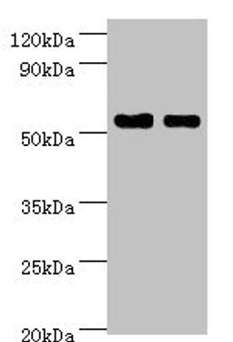Western blot. All lanes: SHMT1 antibody at 7µg/ml. Lane 1: Hela whole cell lysate. Lane 2: HepG2 whole cell lysate. Secondary. Goat polyclonal to rabbit IgG at 1/10000 dilution. Predicted band size: 54, 50, 45, 38 kDa. Observed band size: 54 kDa