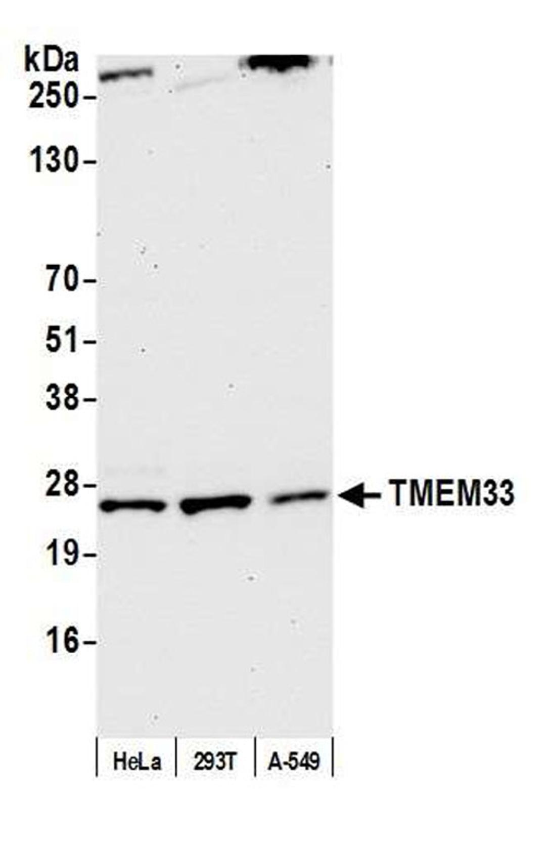 Detection of human TMEM33 by WB.