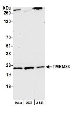 Detection of human TMEM33 by WB.