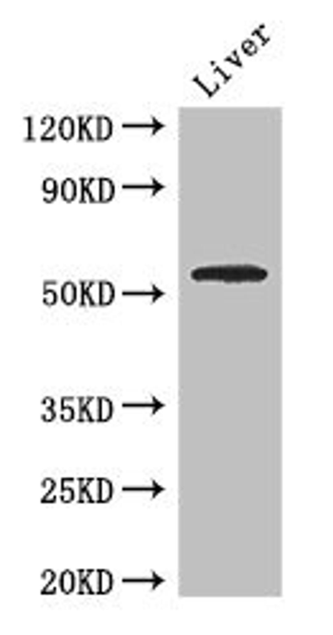 Western Blot. Positive WB detected in: Mouse liver tissue. All lanes: SLC18A1 antibody at 2.7ug/ml. Secondary. Goat polyclonal to rabbit IgG at 1/50000 dilution. Predicted band size: 57, 51, 53 kDa. Observed band size: 57 kDa.