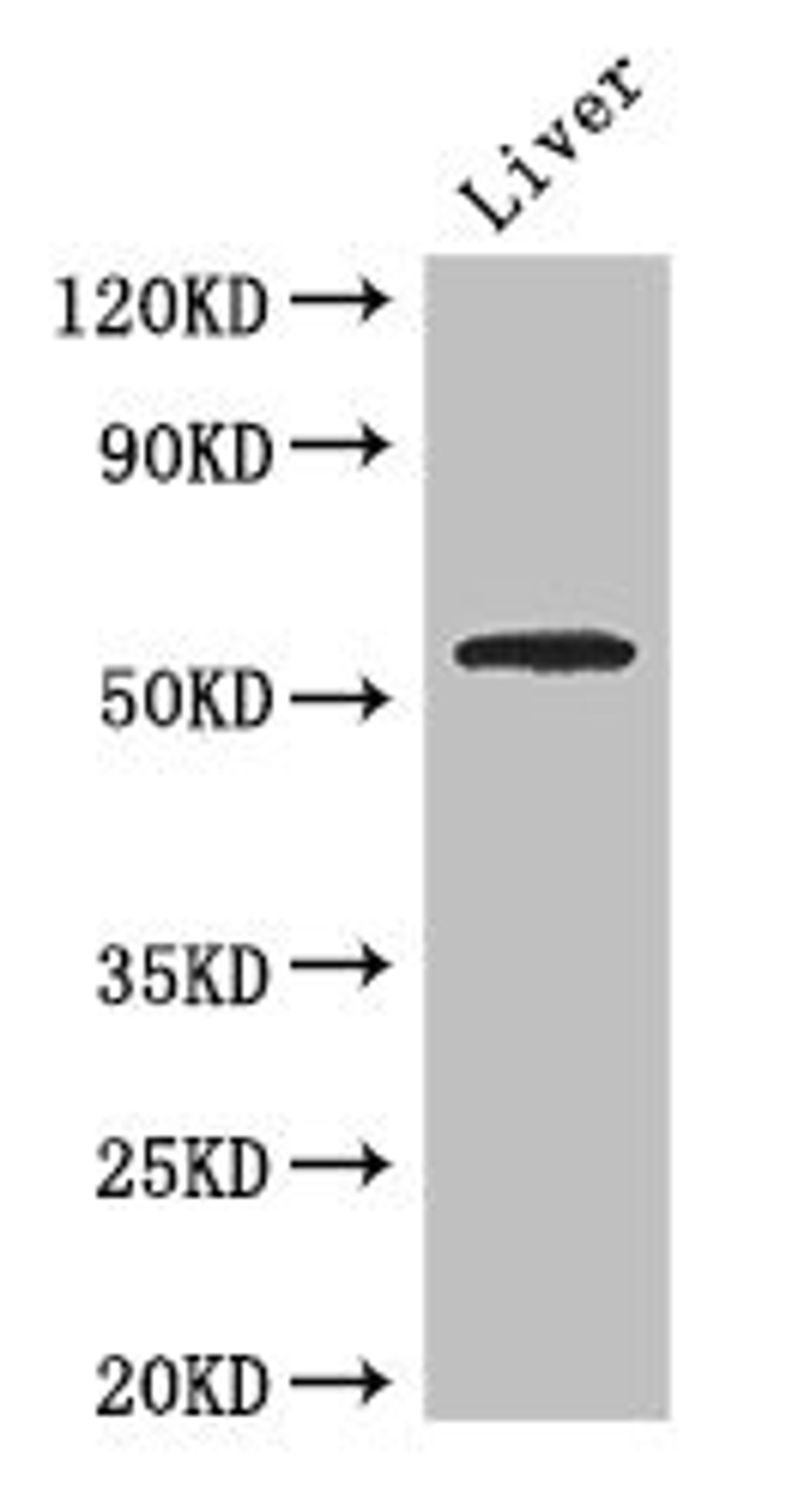 Western Blot. Positive WB detected in: Mouse liver tissue. All lanes: SLC18A1 antibody at 2.7ug/ml. Secondary. Goat polyclonal to rabbit IgG at 1/50000 dilution. Predicted band size: 57, 51, 53 kDa. Observed band size: 57 kDa.