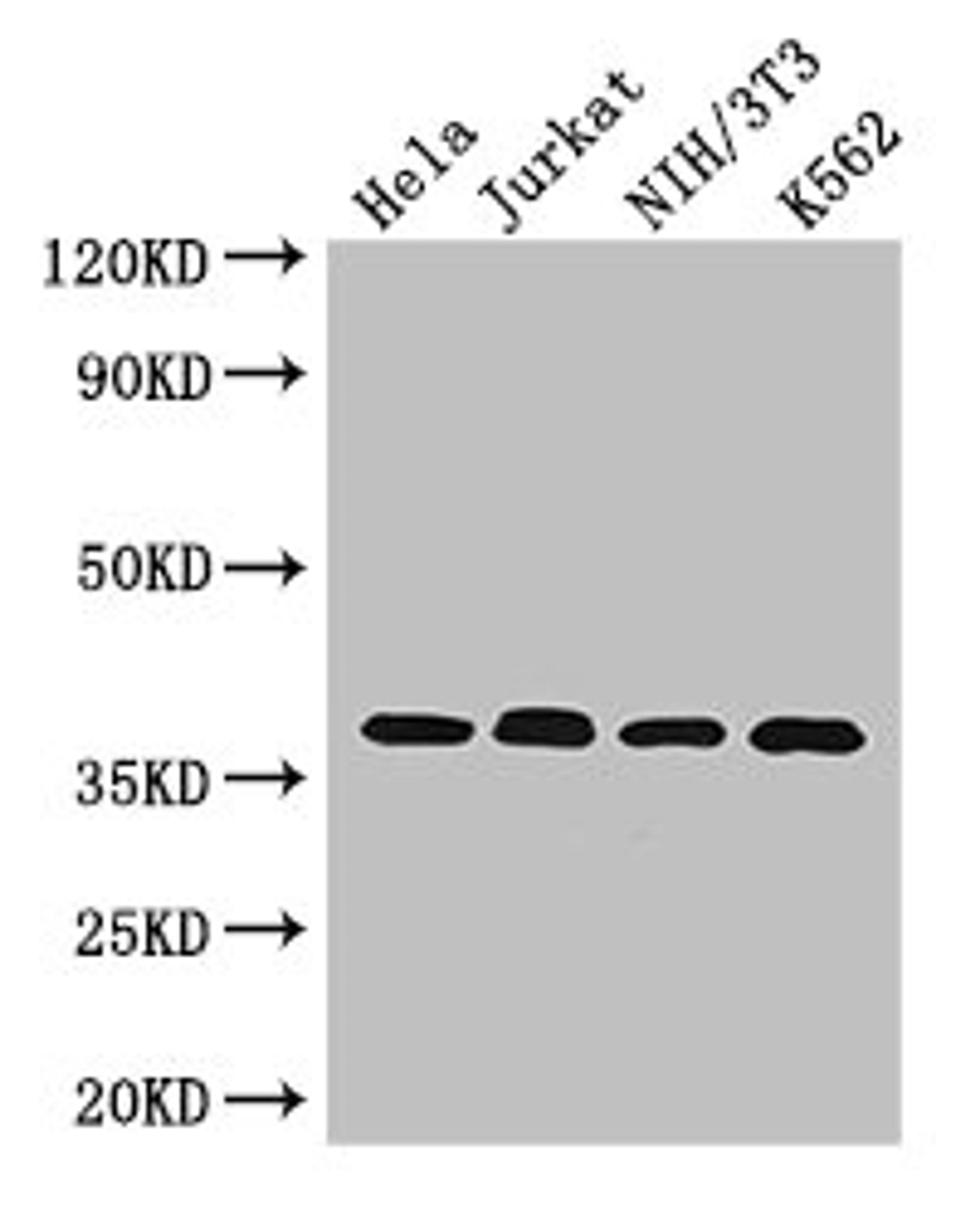 Western Blot. Positive WB detected in: Hela whole cell lysate, Jurkat whole cell lysate, NIH/3T3 whole cell lysate, K562 whole cell lysate. All lanes: RAD51 antibody at 2.7µg/ml. Secondary. Goat polyclonal to rabbit IgG at 1/50000 dilution. Predicted band size: 37, 27, 32 kDa. Observed band size: 37 kDa