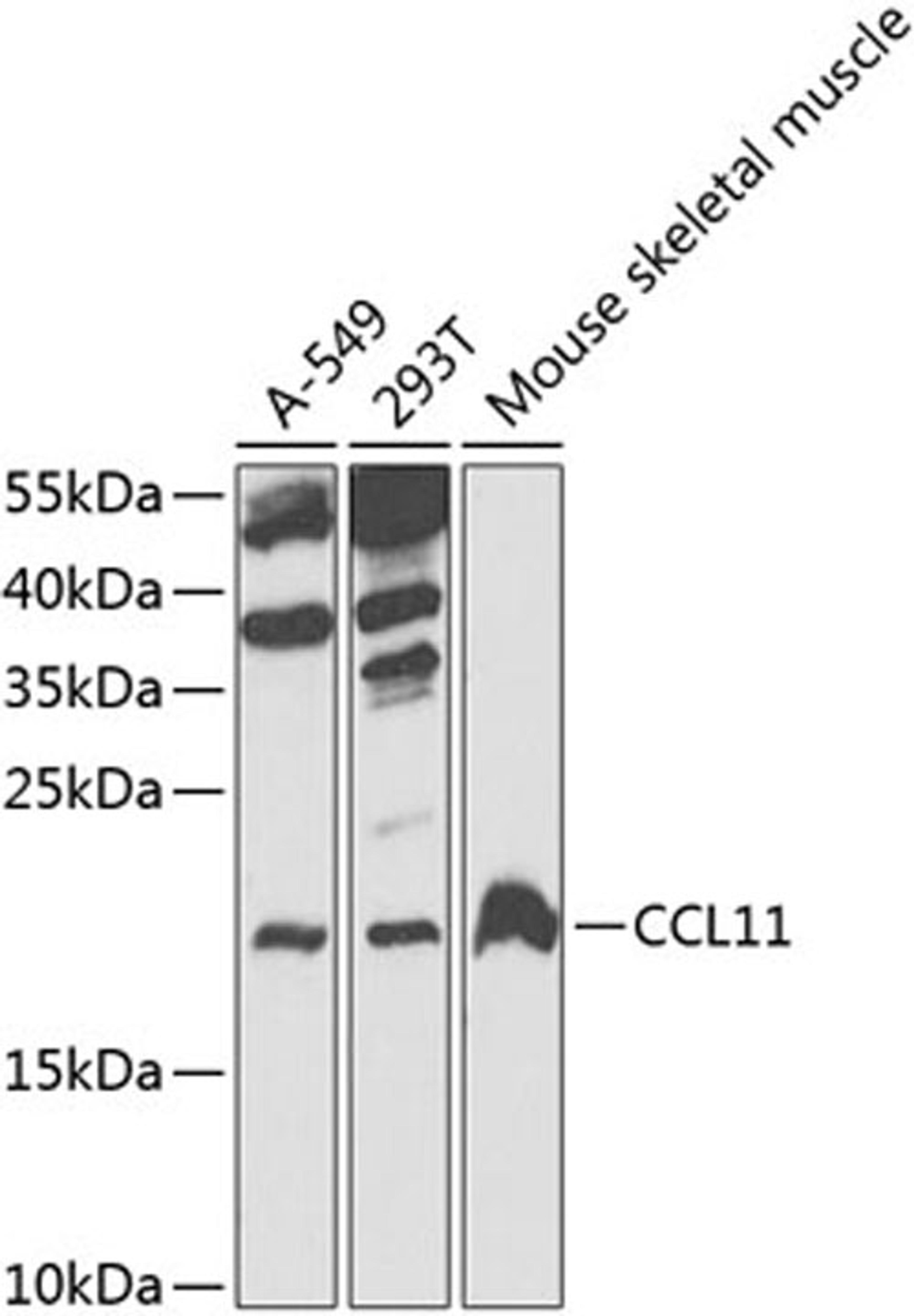 Western blot - CCL11 antibody (A7569)