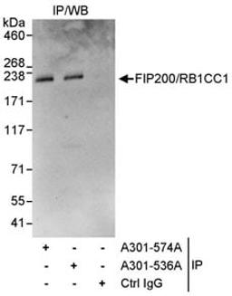 Detection of human FIP200/RB1CC1 by western blot of immunoprecipitates.