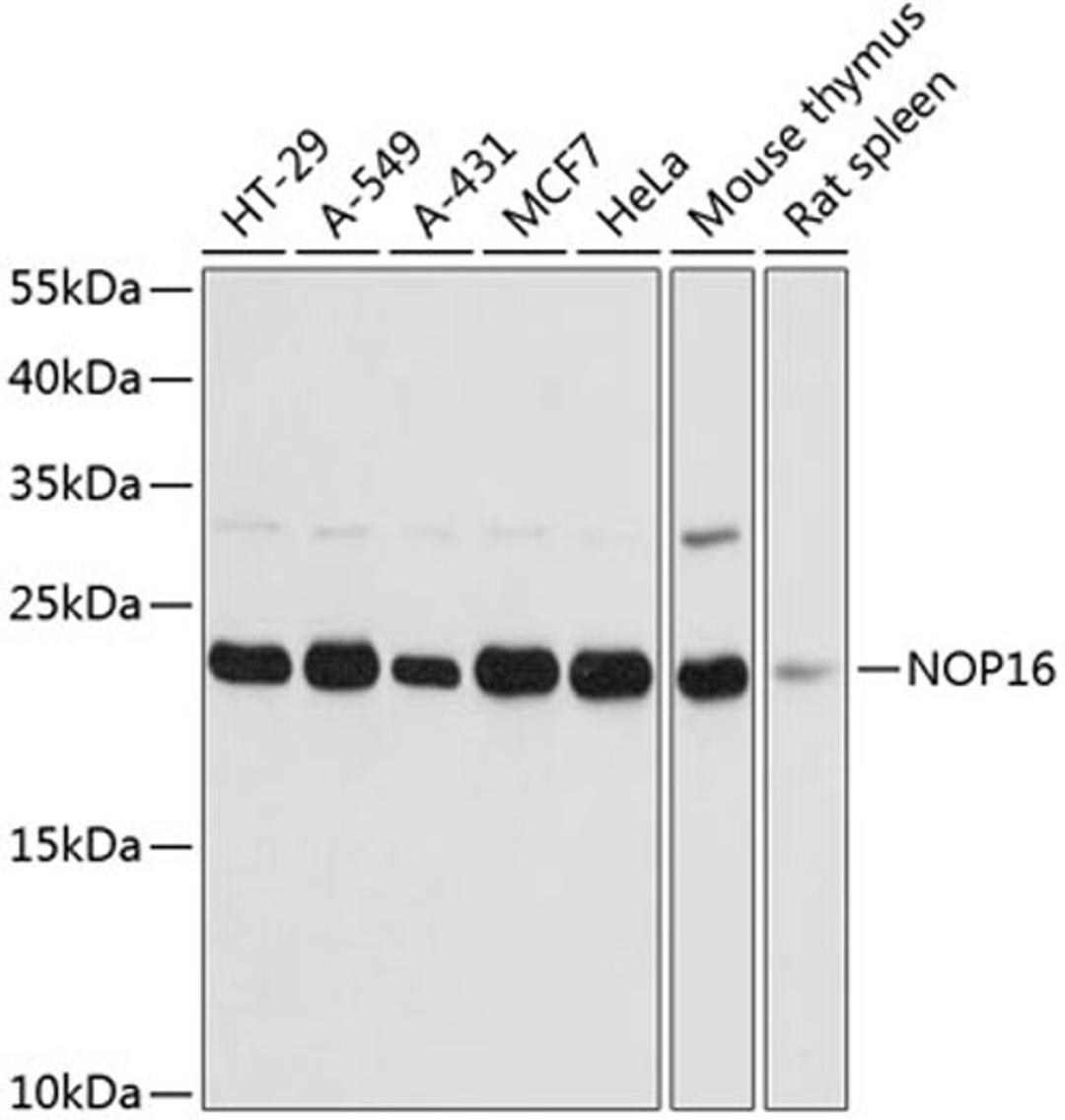 Western blot - NOP16 antibody (A14128)