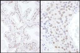 Detection of human and mouse SAE2 by immunohistochemistry.