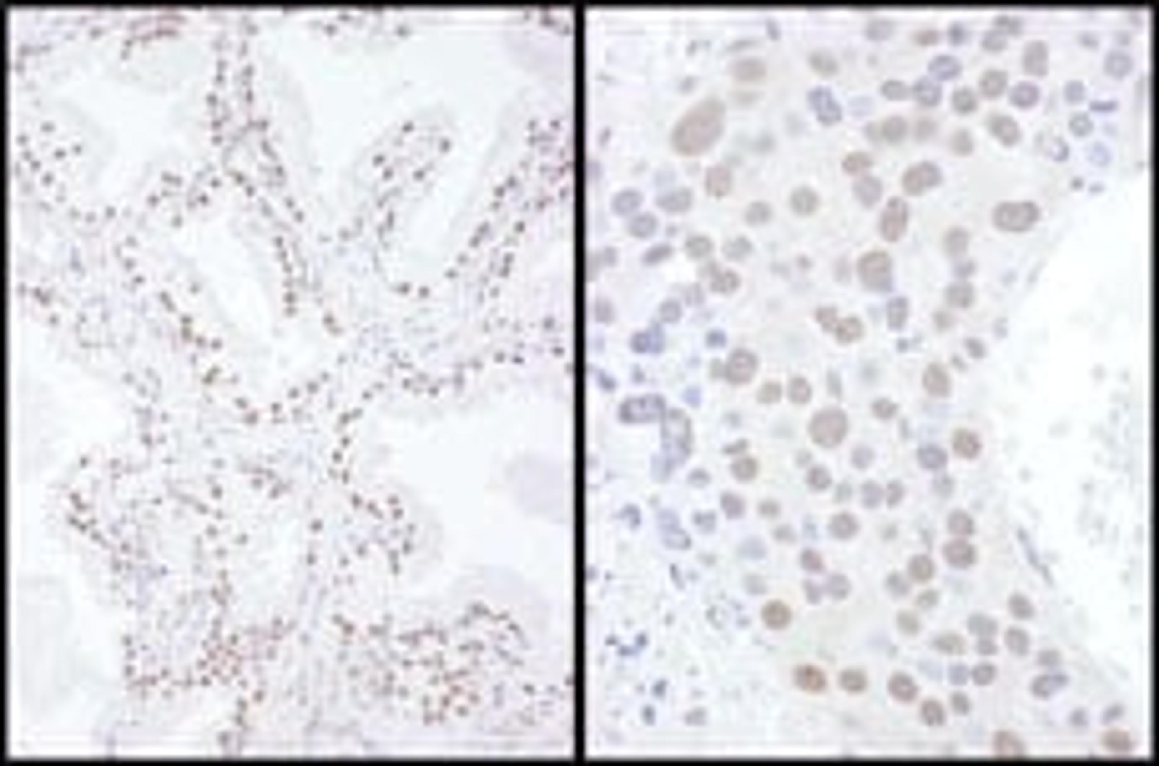 Detection of human and mouse SAE2 by immunohistochemistry.