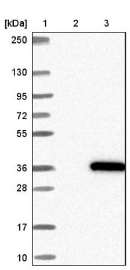 Western Blot: KCTD4 Antibody [NBP1-92045] - Lane 1: Marker [kDa] 250, 130, 95, 72, 55, 36, 28, 17, 10<br/>Lane 2: Negative control (vector only transfected HEK293T lysate)<br/>Lane 3: Over-expression lysate (Co-expressed with a C-terminal myc-DDK tag (~3.1 kDa) in mammalian HEK293T cells, LY405055)