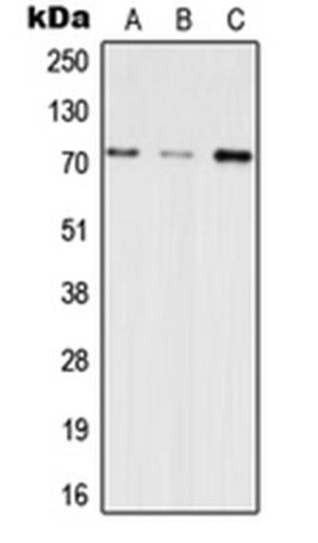 Western blot analysis of HEK293T (Lane 1), SP2/0 (Lane 2), H9C2 (Lane 3) whole cell lysates using INPP5E antibody