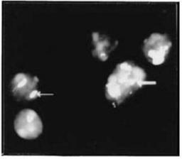 Immunocytochemistry/Immunofluorescence: Nucleolin Antibody [NB600-241] - In-situ immunofluorescent staining of PD31 murine pre-B cells.