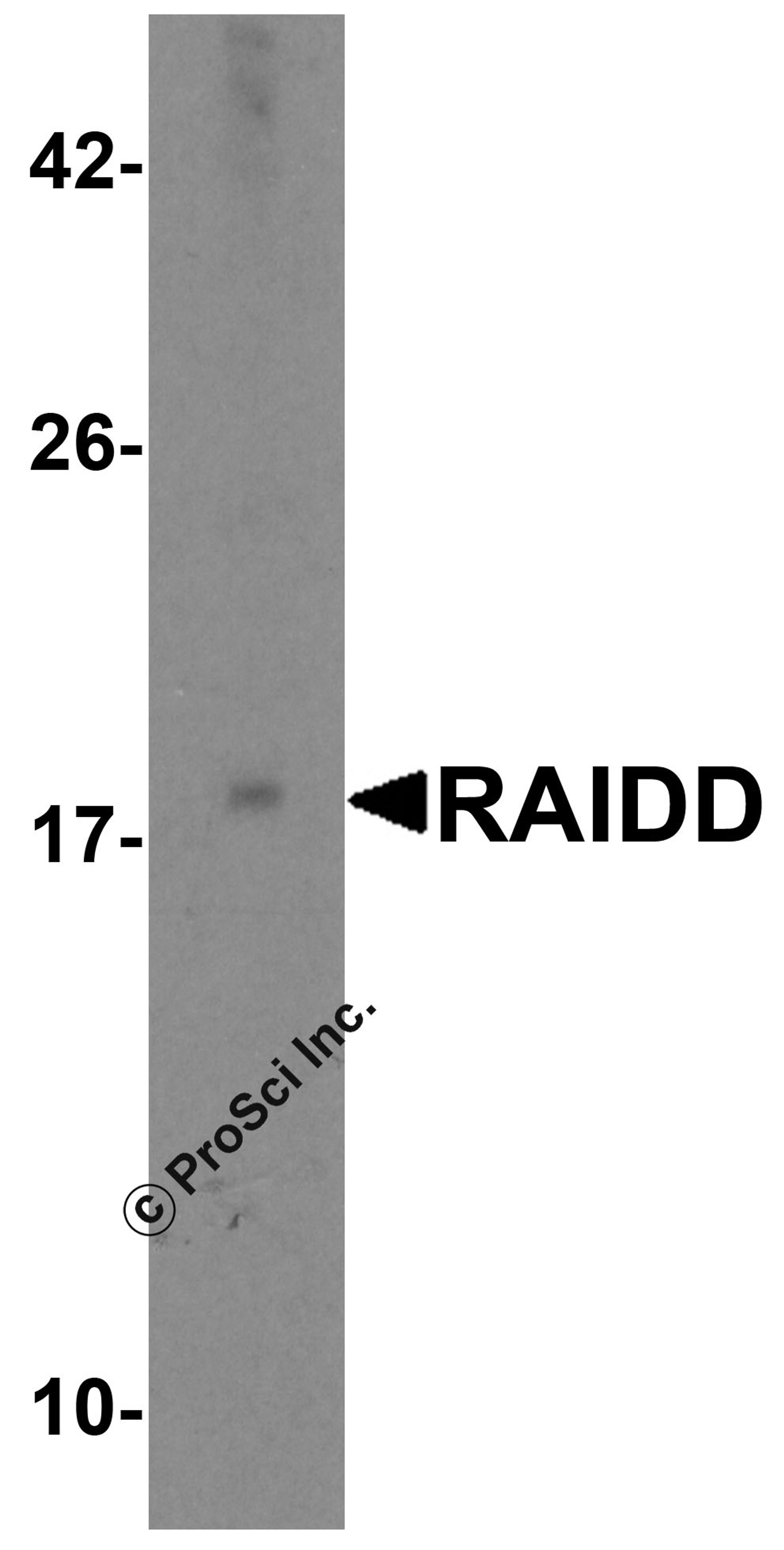 Western blot analysis of RAIDD in MCF7 total cell lysate with RAIDD antibody at 2 μg/mL.