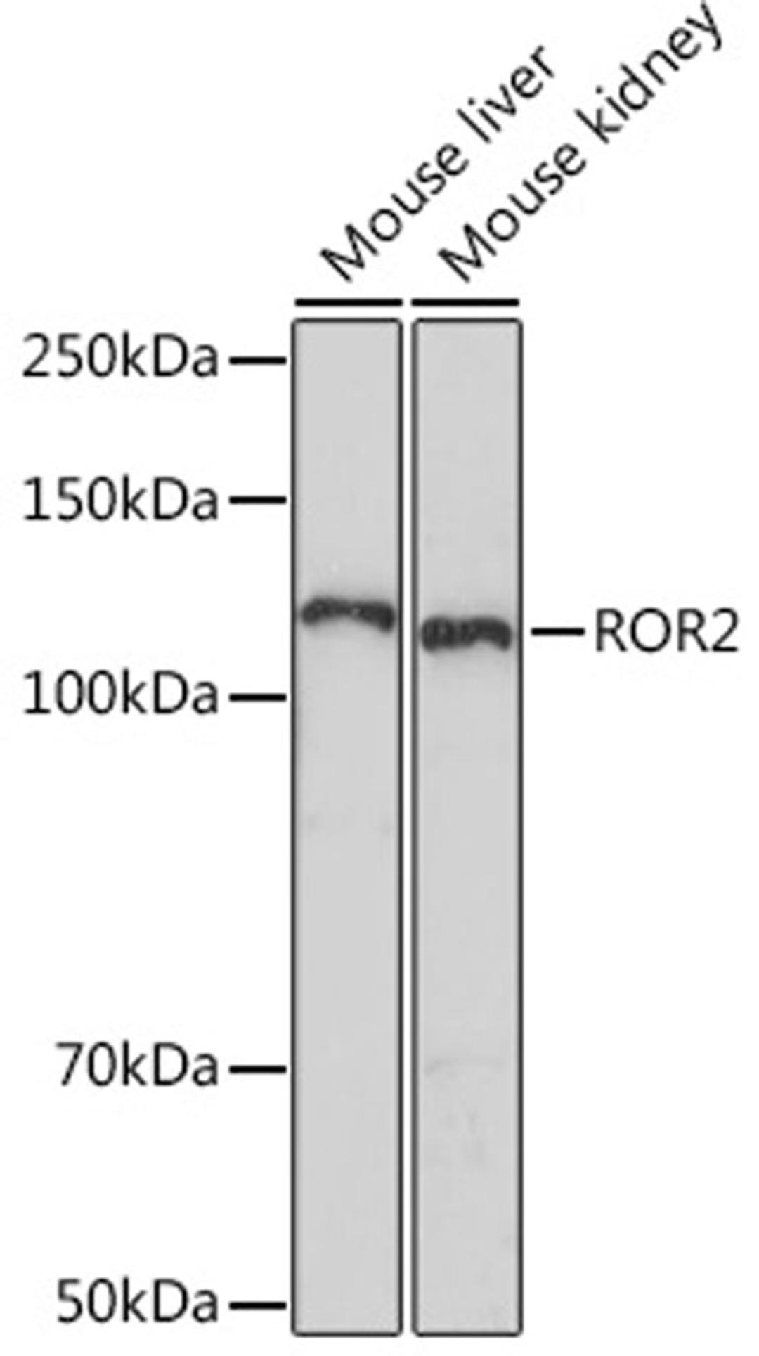 Western blot - ROR2 Rabbit mAb (A5120)