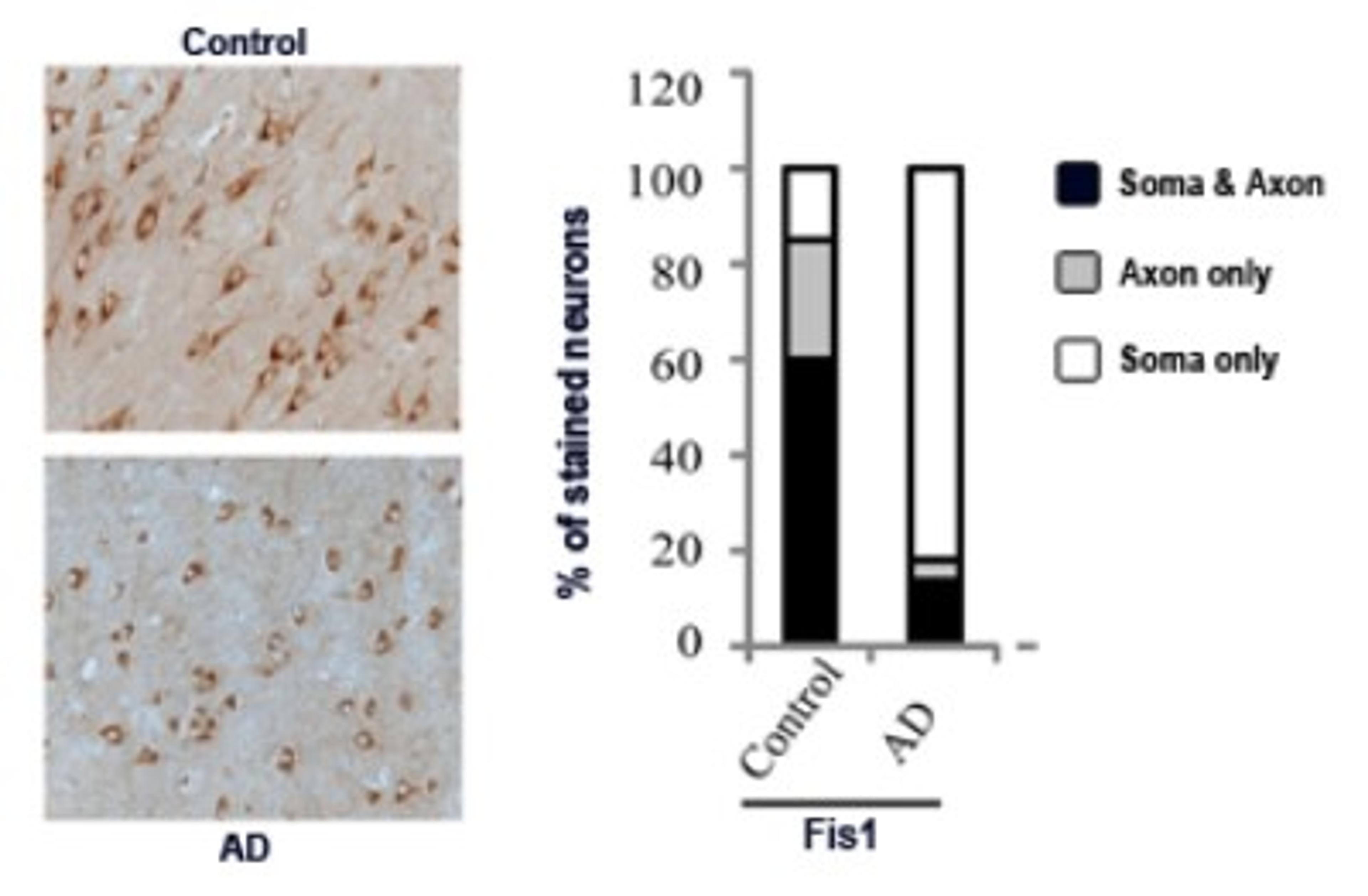 Immunohistochemistry-Paraffin: TTC11 Antibody [NB100-56646] - Analysis of methcarn-fixed, paraffin-embedded hippocampus from control (normal) and Alzheimer brain. Quantification in five AD brains and five age-matched controls indicated that Fis1 was detected in only the soma in ~80% of pyramidal neurons in AD hippocampus, significantly different from what was seen for control hippocampal neurons. Source: Wang et al, 2009.