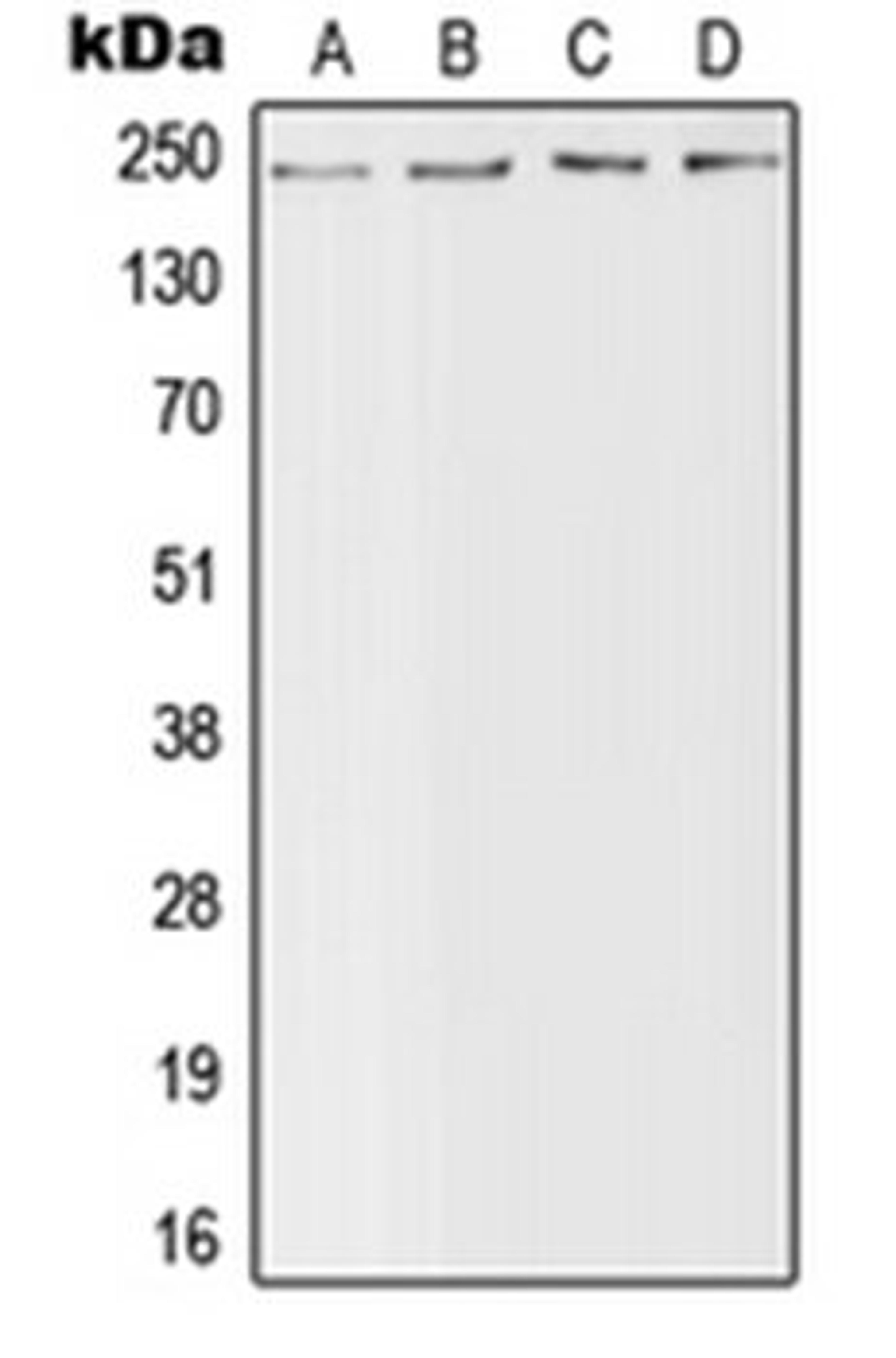 Western blot analysis of MCF7 (Lane 1), NIH3T3 (Lane 2), H9C2 (Lane 3), mouse brain (Lane 4) whole cell lysates using SCN4A antibody