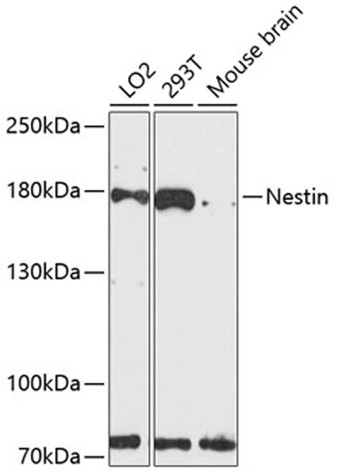 Western blot - Nestin antibody (A11861)