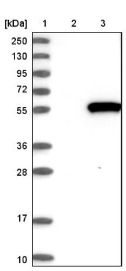 Western Blot: PDE7B Antibody [NBP1-85987] - Lane 1: Marker [kDa] 250, 130, 95, 72, 55, 36, 28, 17, 10<br/>Lane 2: Negative control (vector only transfected HEK293T lysate)<br/>Lane 3: Over-expression lysate (Co-expressed with a C-terminal myc-DDK tag (~3.1 kDa) in mammalian HEK293T cells, LY402727)