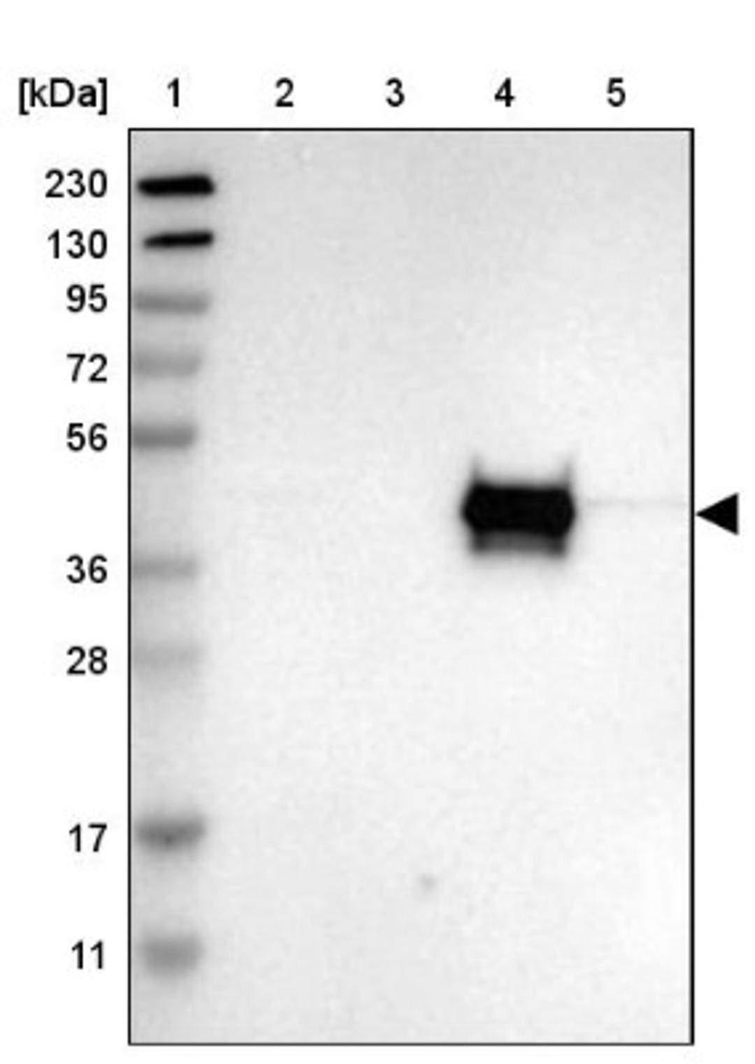 Western Blot: TRIM59 Antibody [NBP1-82625] - Lane 1: Marker [kDa] 230, 130, 95, 72, 56, 36, 28, 17, 11<br/>Lane 2: Human cell line RT-4<br/>Lane 3: Human cell line U-251MG sp<br/>Lane 4: Human plasma (IgG/HSA depleted)<br/>Lane 5: Human liver tissue