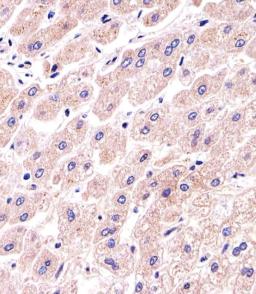 Immunohistochemical analysis of paraffin-embedded H. liver section using PPP2R2A Antibody (N-term). Antibody was diluted at 1:25 dilution. A undiluted biotinylated goat polyvalent antibody was used as the secondary, followed by DAB staining.