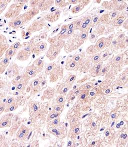 Immunohistochemical analysis of paraffin-embedded H. liver section using PPP2R2A Antibody (N-term). Antibody was diluted at 1:25 dilution. A undiluted biotinylated goat polyvalent antibody was used as the secondary, followed by DAB staining.